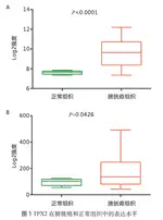 Expression of targeting protein for TPX2 in bladder cancer and its clinical significance